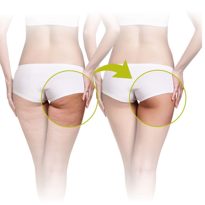 LANAFORM CELL ROLLER 3
